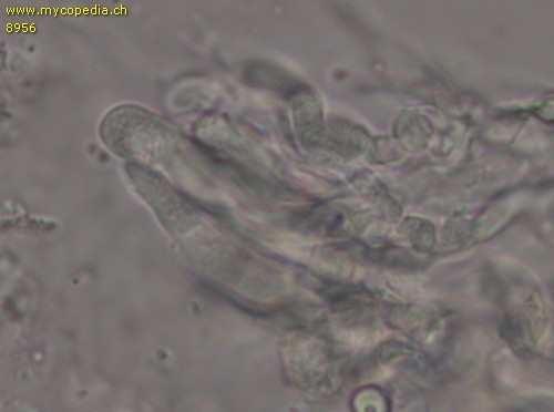 Vesiculomyces citrinus - Gloeozystiden - 