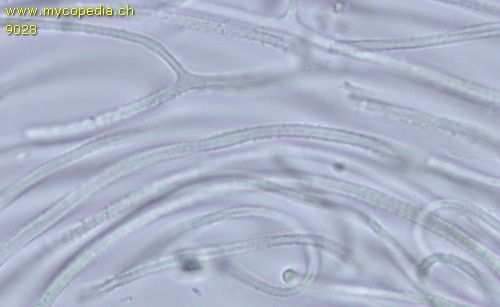 Dacrymyces stillatus - Hyphen inkrustiert - 