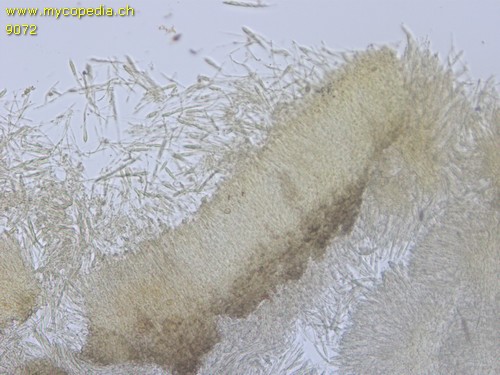 Tapesia fusca - 