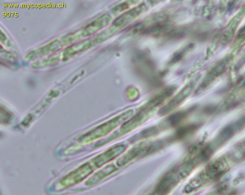 Tapesia fusca - Sporen - 