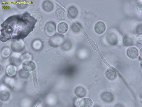 Ceratiomyxa fruticulosa - Hyphen - 