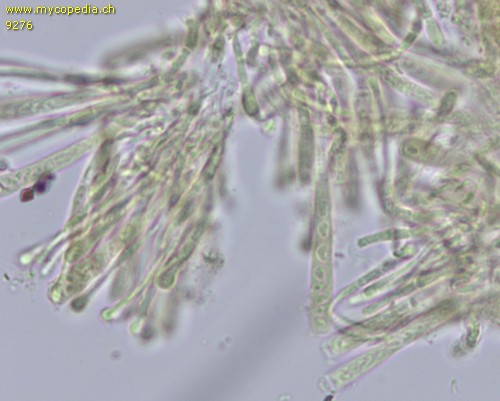 Orbilia xanthostigma - 