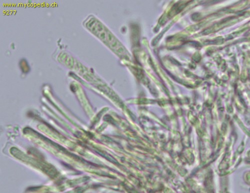 Orbilia xanthostigma - 