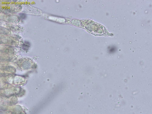 Russula nigricans - Cheilozystiden - 