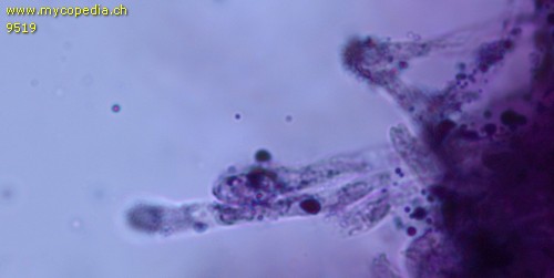 Russula rosea - Primoridalhyphen inkrustiert - 