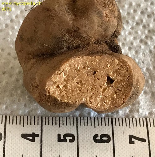 Tuber excavatum - 