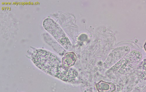 Entoloma chloropolium - Basidien - 