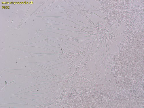 Tricholomopsis rutilans - Cheilozystiden - 