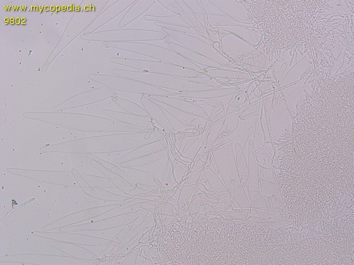 Tricholomopsis rutilans - Cheilozystiden - 