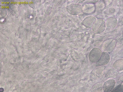 Sebacina incrustans - Hypobasidien - 