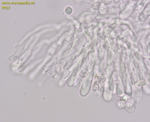 Clitopilus geminus - Cheilozystiden - 