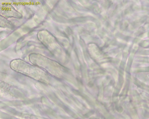 Steccherinum ochraceum - Skeletozystiden inkrustiert - 