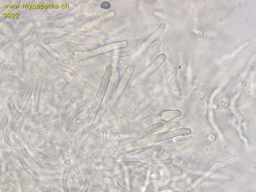 Steccherinum ochraceum - Skeletozystiden inkrustiert - 