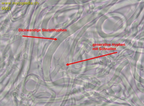 Steccherinum ochraceum - dimitisches Hyphensystem - 