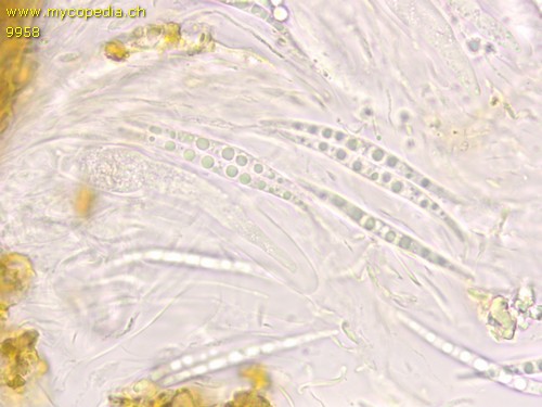 Tubeufia cerea - Spore/n - Wasser  - 